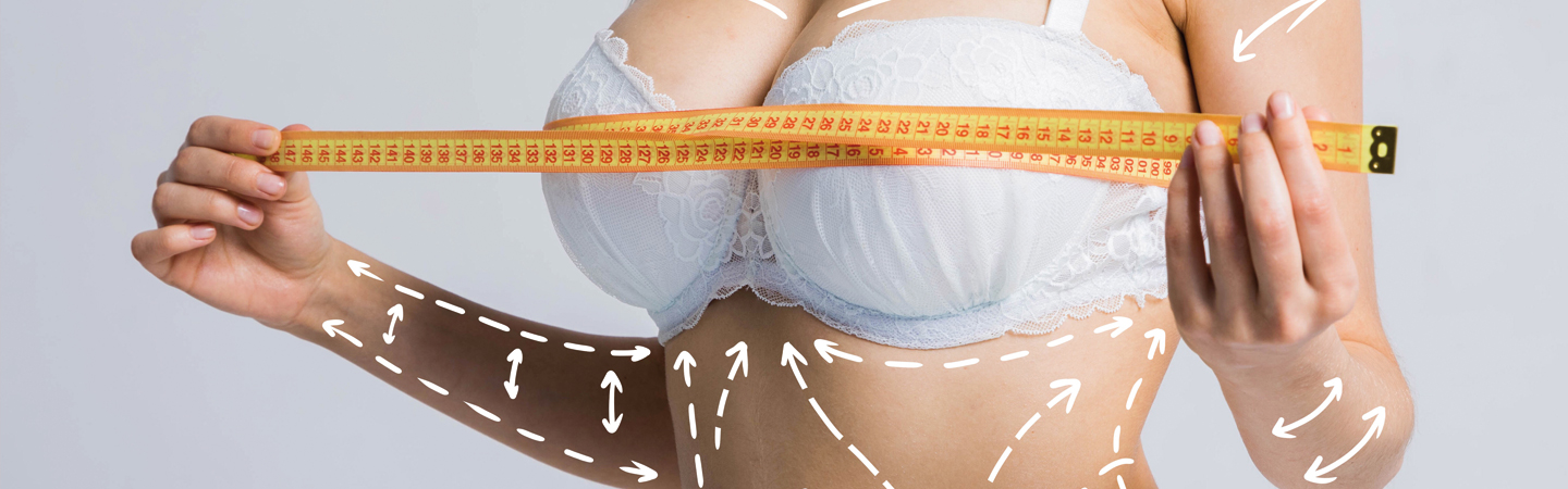 Breast augmentation with lift